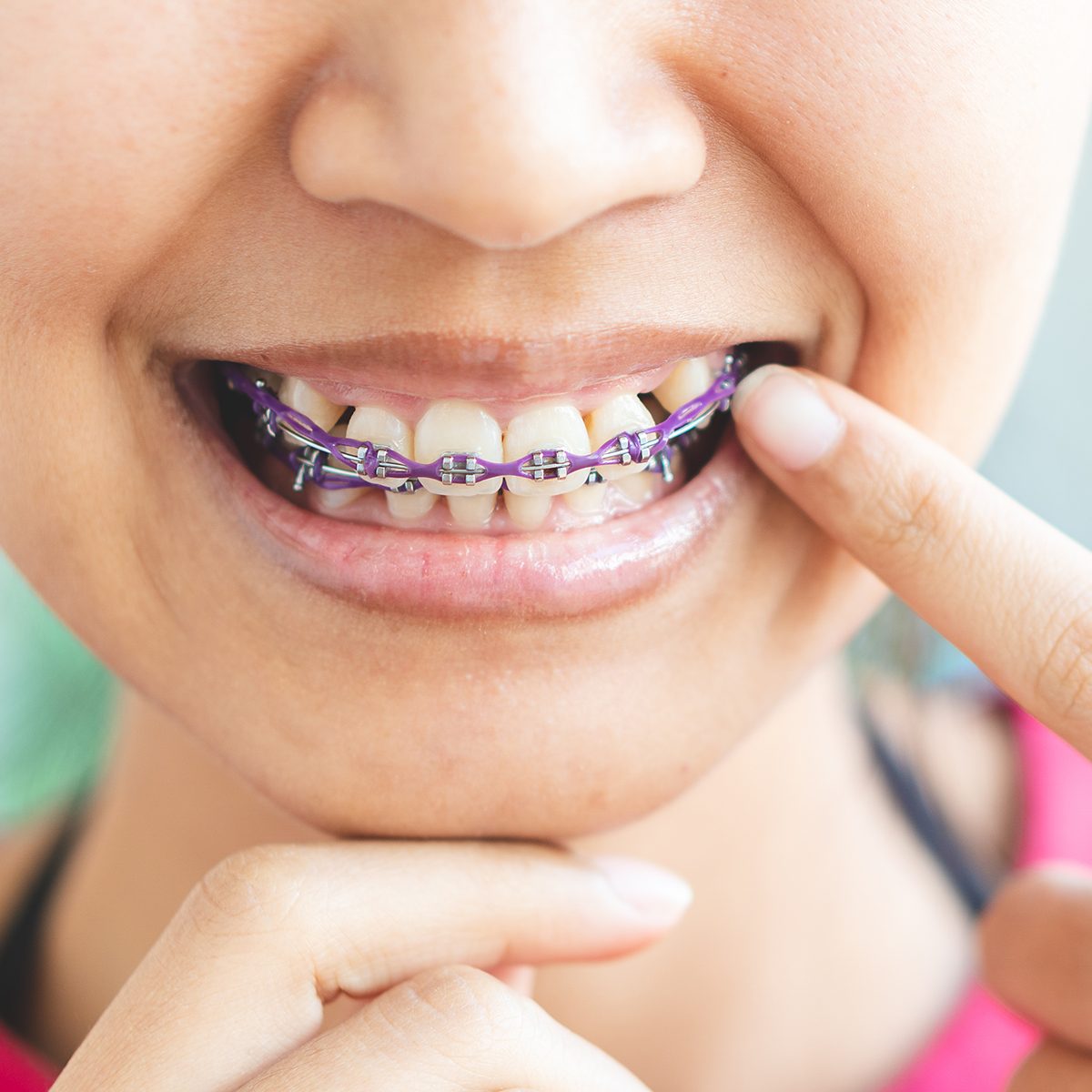 Women braces and is dirty, not beautiful.